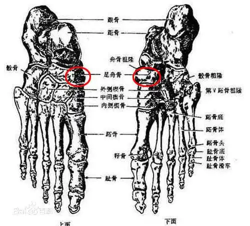 左足足舟骨是什么样子