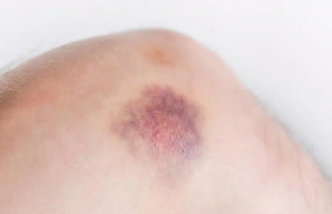 肝癌"降临"的6大症状,不想肝脏"癌变",做好这3件事