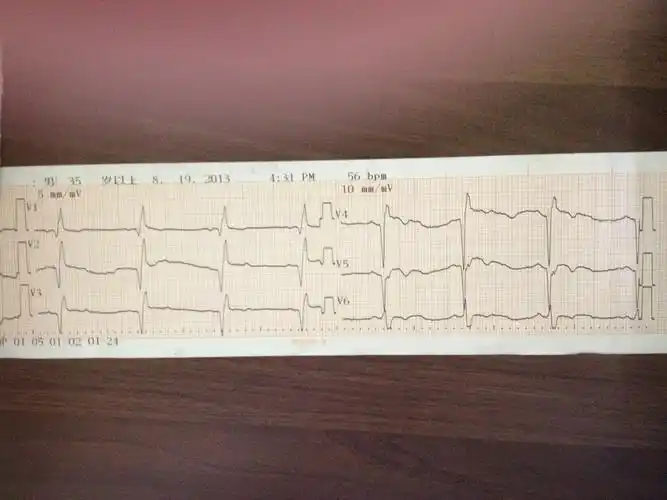 心电图脑电图专业讨论版 - 爱爱医医学论坛