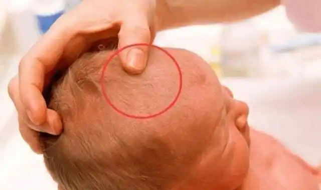 出生时分为前囟门和后囟门,很多家长不重视后囟门,是因为靠近头部的