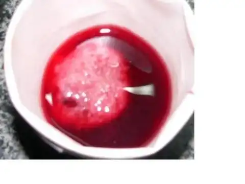 药流下来的孕囊照片谁有?