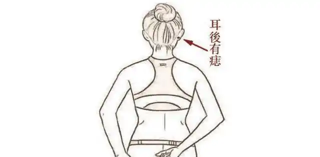 暗财痣:耳后有痣,福禄深沉