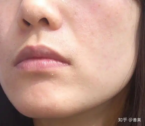 本人干皮,想知道你们早晚怎么护肤?