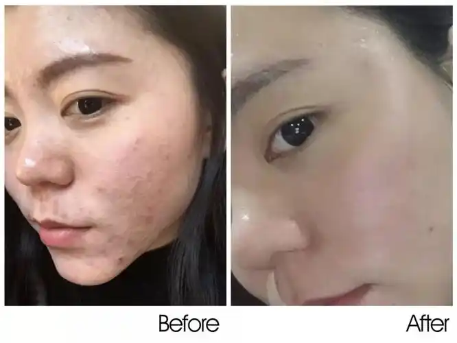 你与美肤大咖之间只差一个冻干粉的距离!