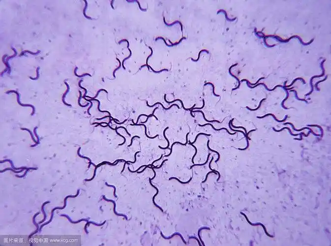 口腔细菌显微镜