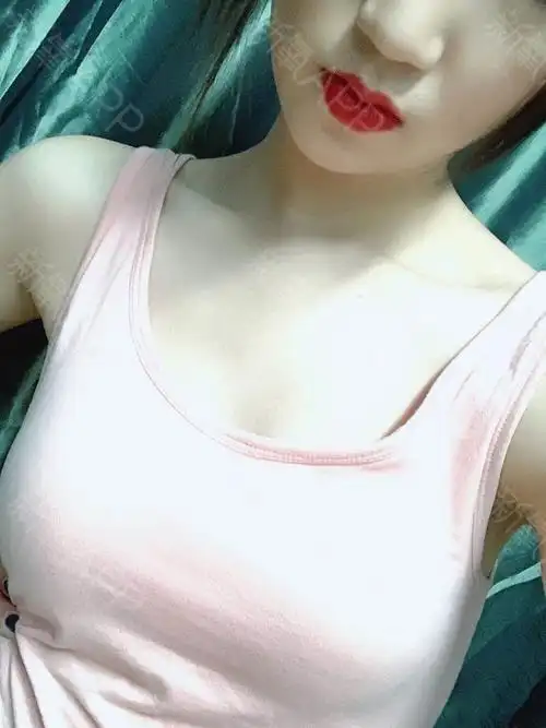胸部恢复的越来越好了,大概现在是c罩杯吧,炒鸡满意_圈子-新氧美容
