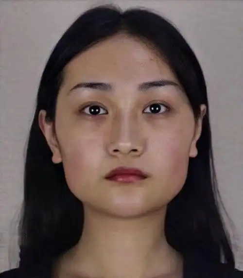 小姐姐磨骨90天全纪录,从正宗国字脸变成小v脸|颧骨|脸型|下颌_新浪