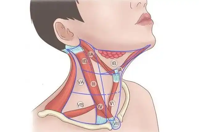 脖子淋巴结在哪个位置图片
