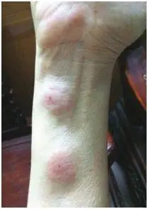 被通缉的锥蝽到底是什么鬼