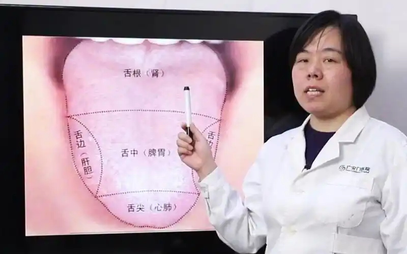 舌诊自诊告诉你为什么中医看病先看舌头