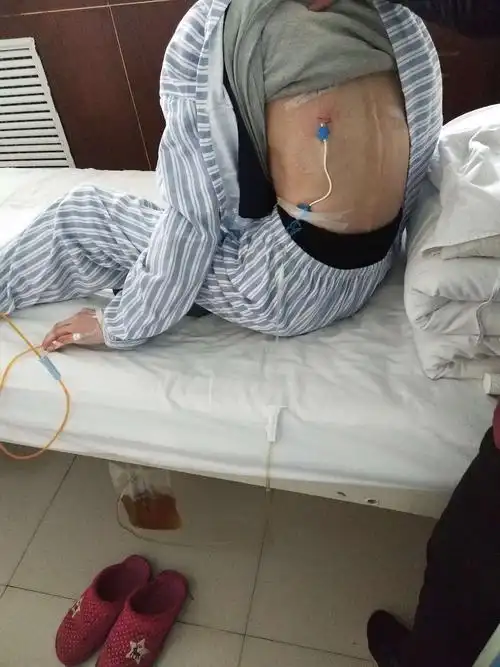 襄垣县人民医院〕感染性疾病科成功独立开展首例用中心静脉导管行