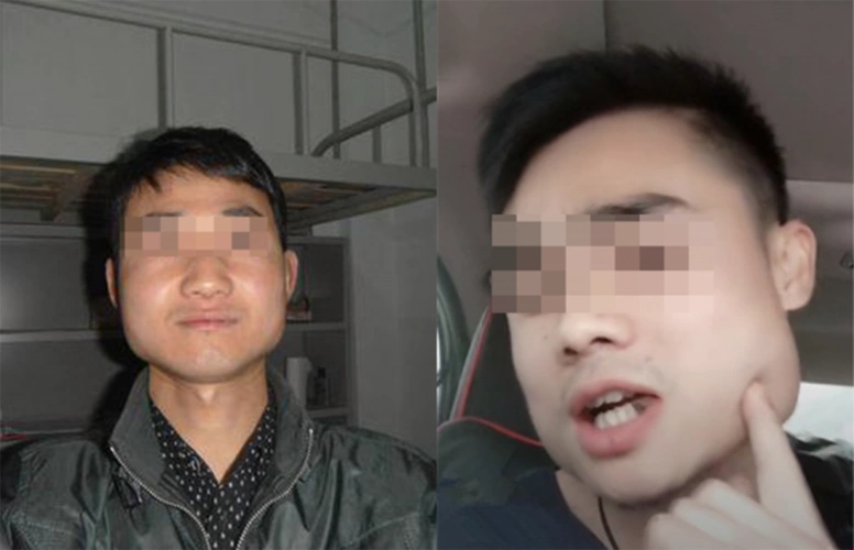 槟榔之殇:成瘾只是表象,6000万人的爱好,如何成割脸的诱因