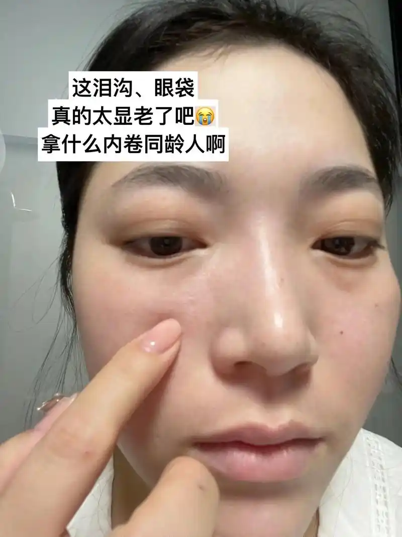 眼部这个状态,到底怎么自救啊?有跟我一样眼部凹的姐妹嘛01 - 抖音