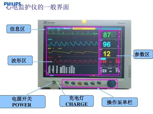 心电监护仪的一般界面 信息区 参数区 波形区 电源开关 power 充电灯