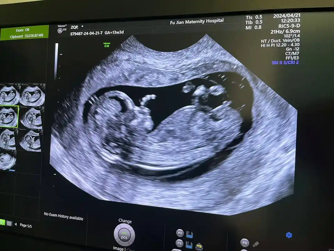 nt已过,接下来我们的闯关正式开启啦!希望我们能顺利73 你好好长大