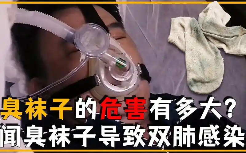 男人只因闻了闻臭袜子,双肺竟真菌感染?