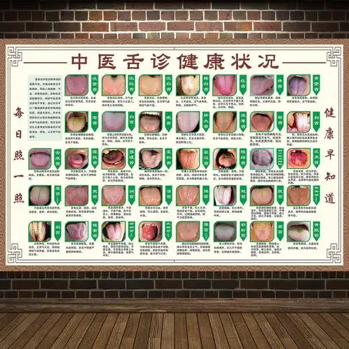 舌诊健康状况对照表图解医院挂图中医经络养生写真
