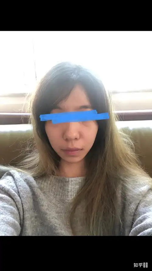 左右脸不对称怎么办?(带图)?