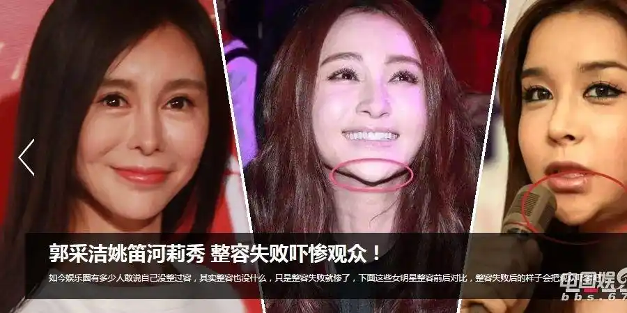 明星整容失败吓惨观众!姚笛下巴被削似三角 姚芊羽嘴歪崩坏