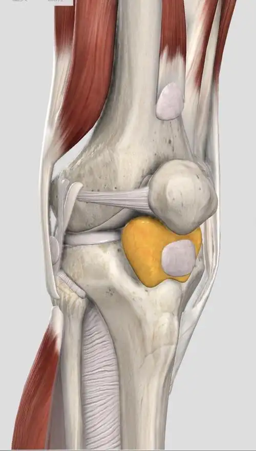 了解了她的主诉后,我们推测其疼痛可能来自这几个原因:髌下脂肪垫炎