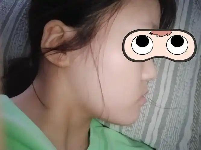 想了解一下这个月牙脸有救吗?