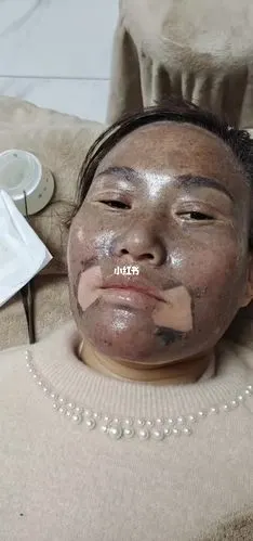 还是秋6061天冬6969祛斑好呢?