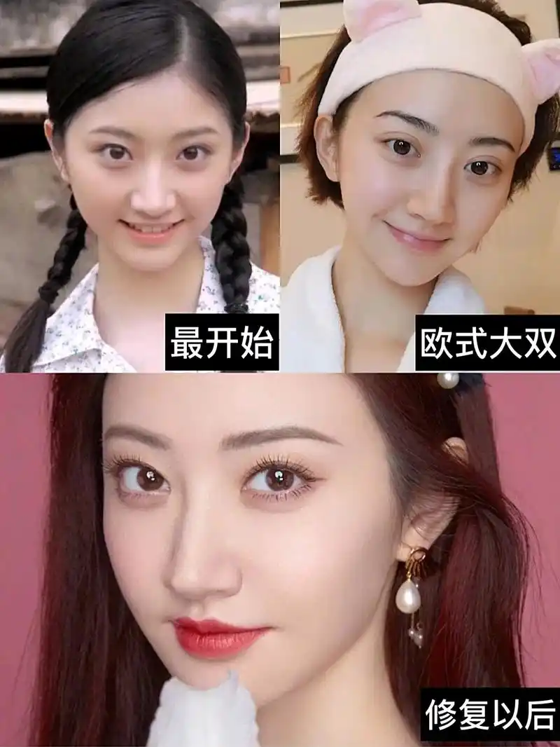 02♀1502♀1502♀15早期景甜的双眼皮98较窄,偏小扇形