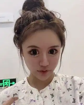 13岁就开始整容的女网红要创纪录了自曝两年内整形超300次