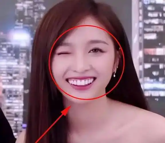 吴宣仪一开口笑,立刻吸引了人们的注意力,因为她满嘴都是牙齿,这种