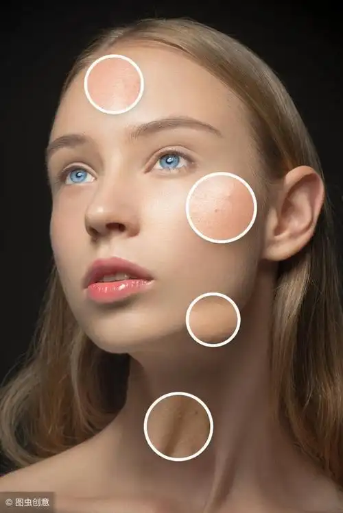 什么是油性皮肤?