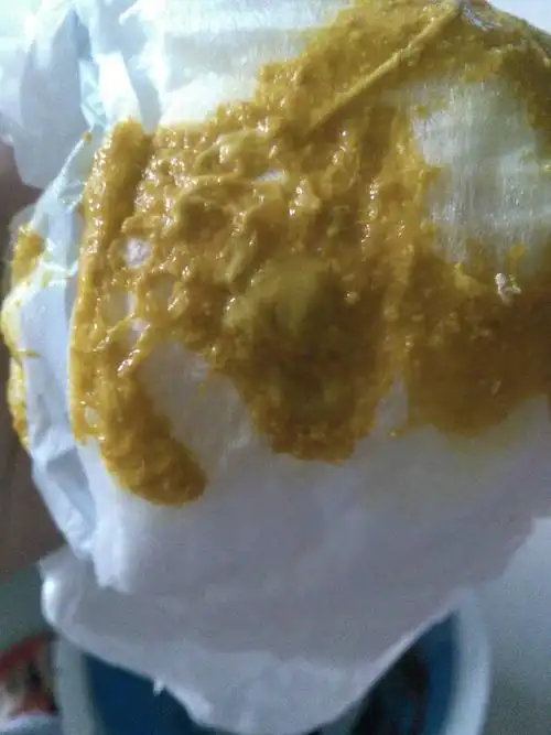 推荐回答 你的孩子的大便性质,可能是消化不良的症状.