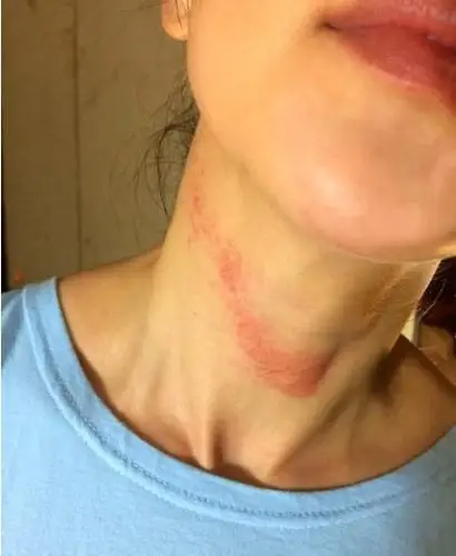 图:李冰冰脖子惊现红痕 遭网友调侃被谁亲成这样?