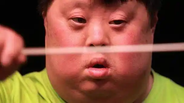 只有7岁智商的成年人,中国有90万,唐氏儿真的很可怕_综合症_染色体