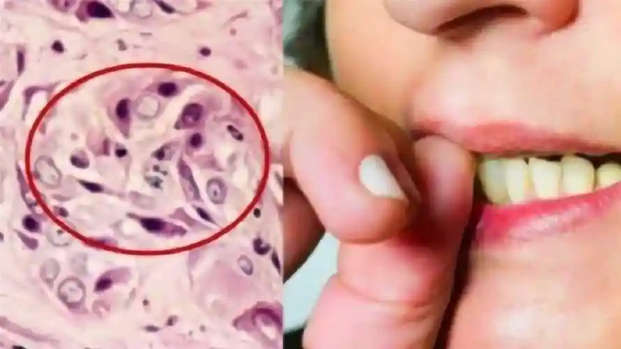 手指甲有多少细菌?显微镜放大100倍,看完瞬间一身鸡皮疙瘩