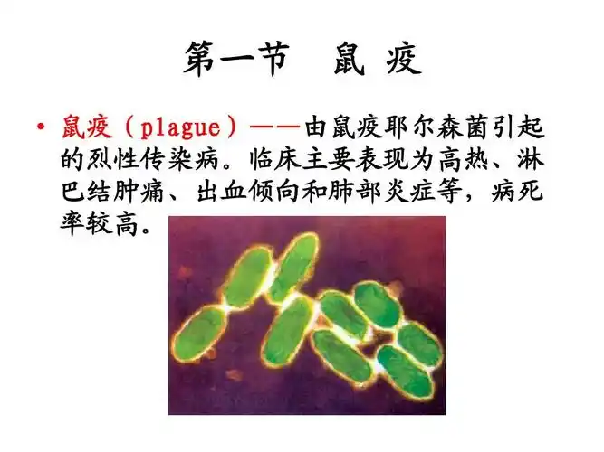 鼠疫ppt