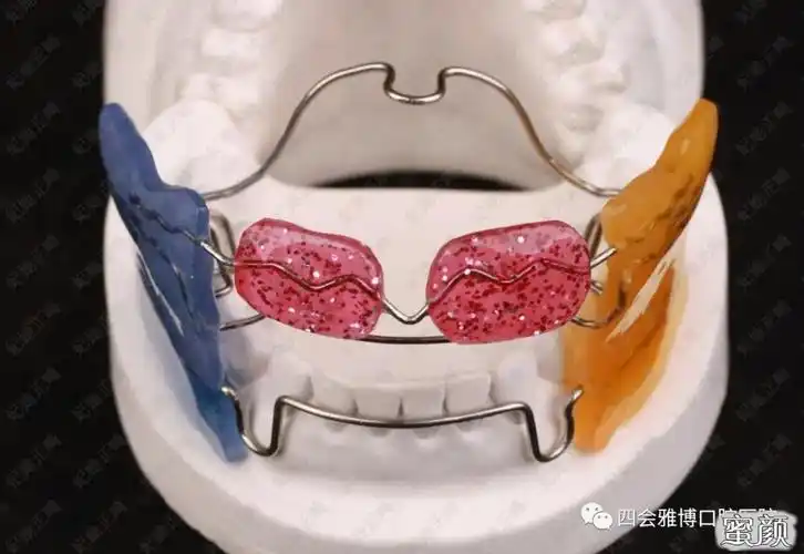 3,前方牵引矫正装置适用于上颌骨发育不全,下颌骨突出的早期骨骼性前