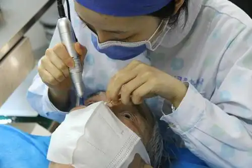 及眼表科主任任毅为袁大伯制定了适合他的诊疗方案:眼部干眼spa治疗