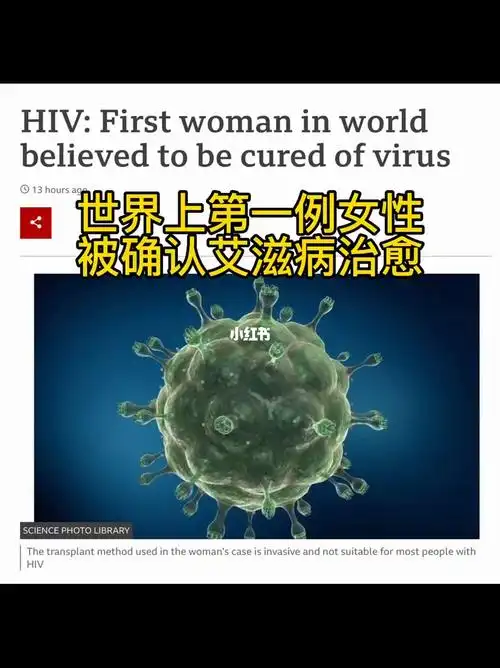 一家三口英语新闻天天练一女性艾滋病治愈