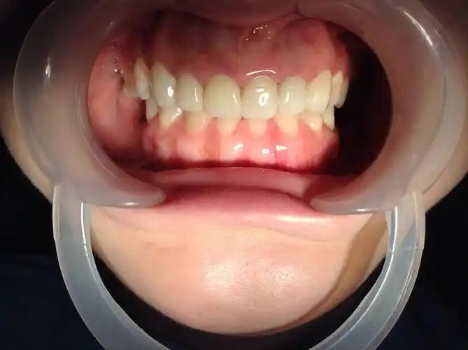 深圳启飞齿科/口腔门诊部/铸就精品齿科