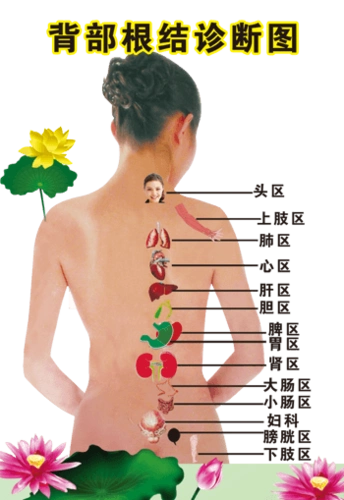 背部根结诊断图