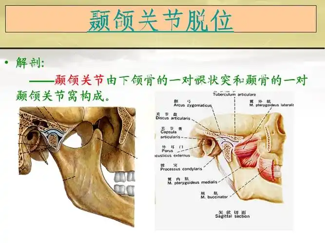 颞颌关节脱位处理