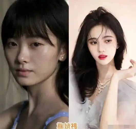而且鞠婧祎自出道以来,一直被质疑整容,从她早期和现在的对比照片来看