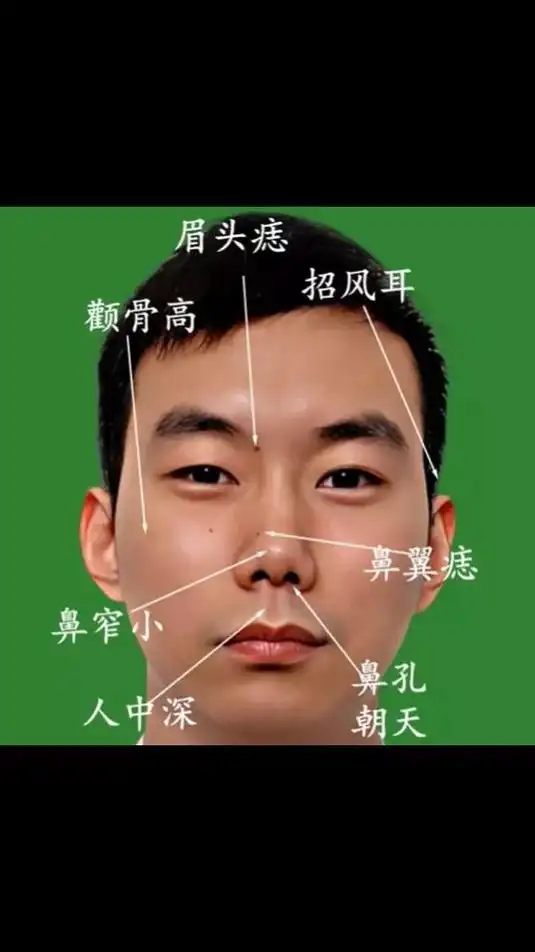 从这对高凸的颧骨可以看出来,鼻子有点窄小,比颧部相配,鼻孕很难支撑