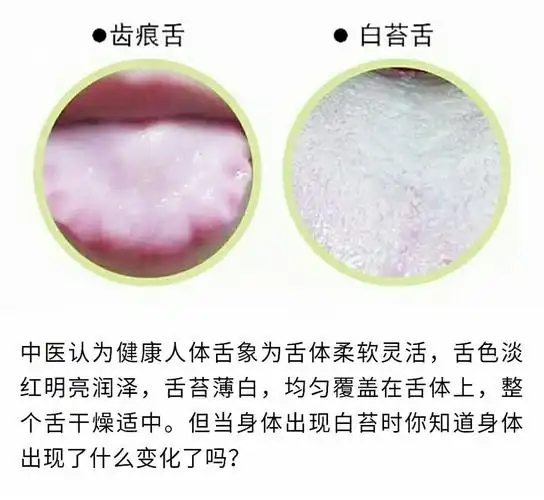 当舌头上出现"白苔",你知道身体想告诉你什么吗?