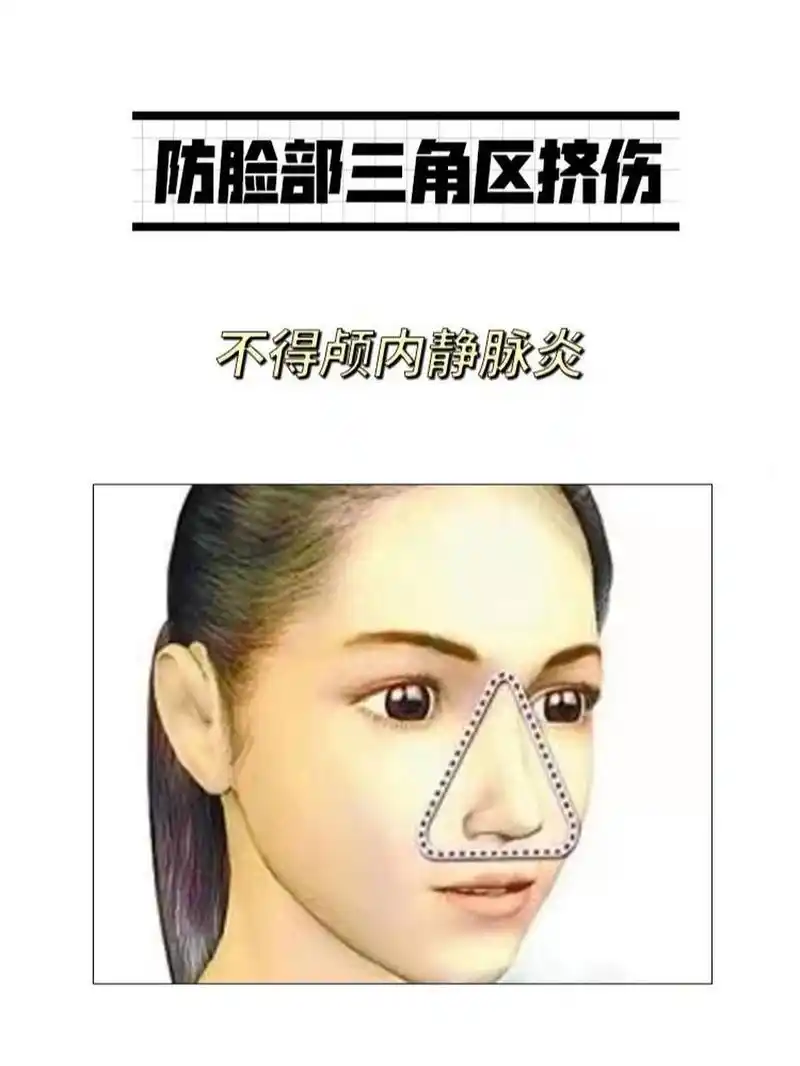 今日健康|脸部三角区 95今日健康分享95 脸部三角区怕挤伤95