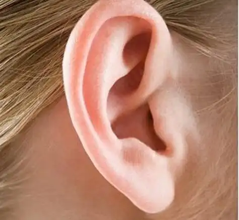 儿童招风耳几岁做矫正好