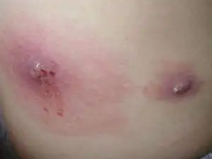 《云南虫谷》中的痋术你知道多少?