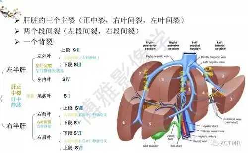 收藏丨肝脏分叶分段的影像解剖