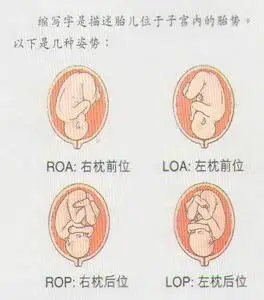 看看各种胎位吧,头位里面也有不好产的胎位,我想哭了