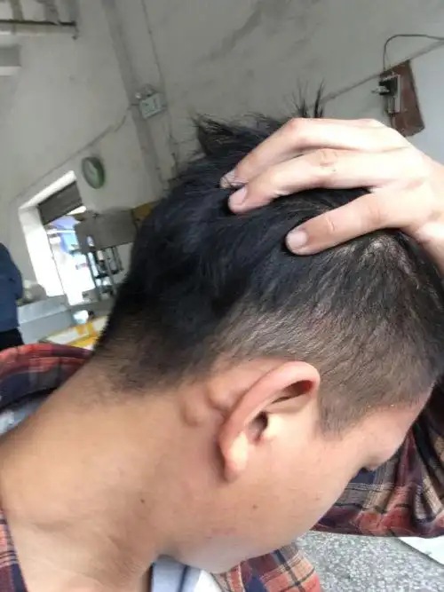 耳朵后面长两个包这是淋巴结吗